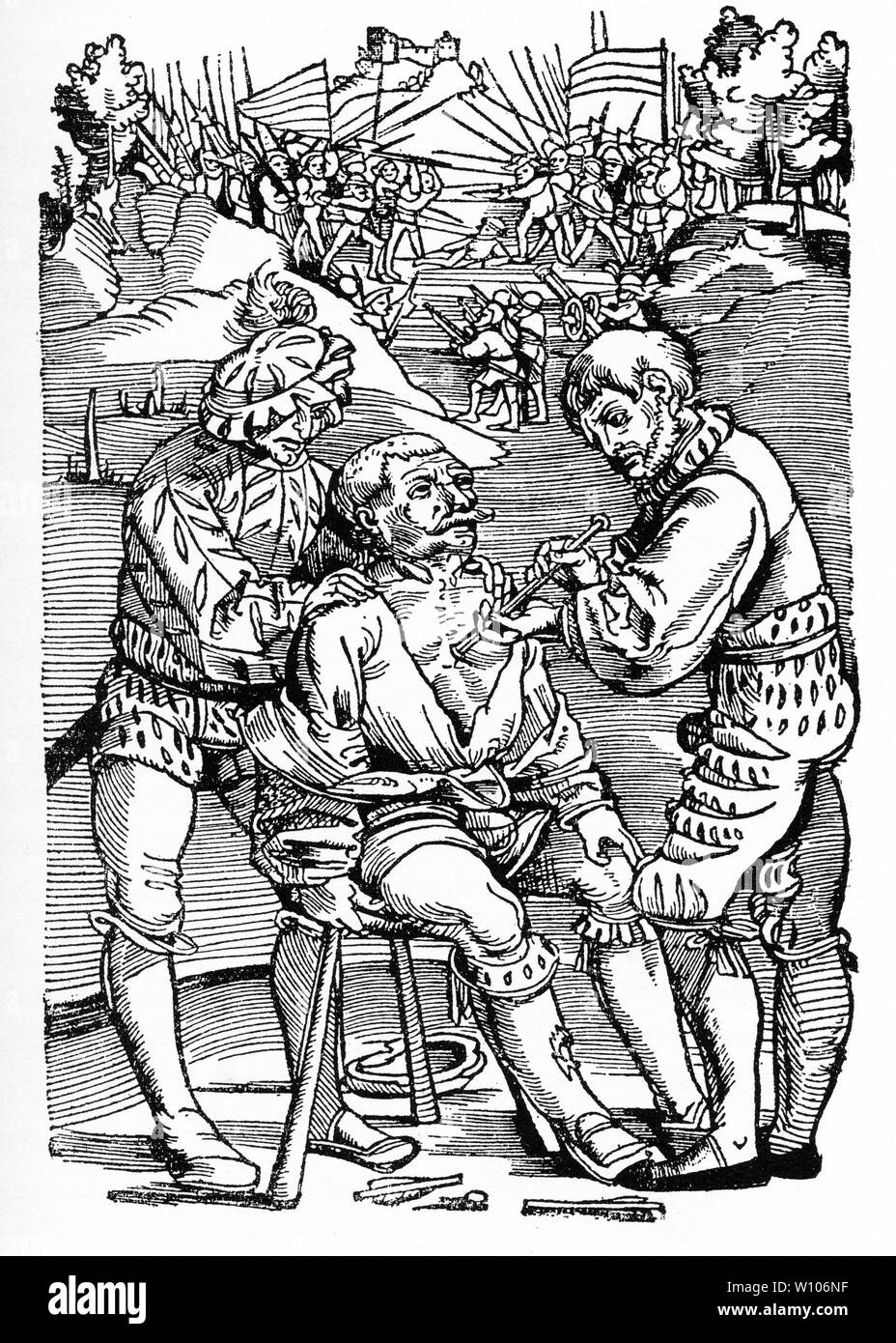 Engraving of a surgeon removing an arrow from a man's chest on the battlefield. From a woodcut from H. Gersdorf,  1528 Stock Photo