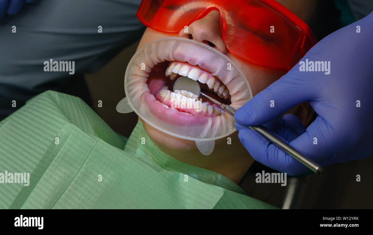 Dentist examines condition of back surface of teeth with help of dental