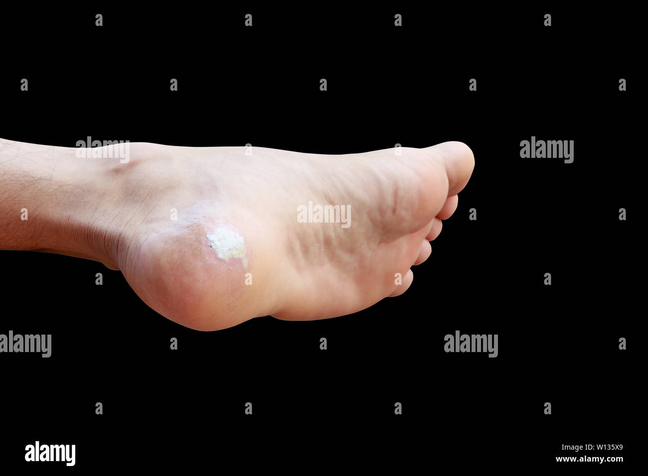 black corn foot