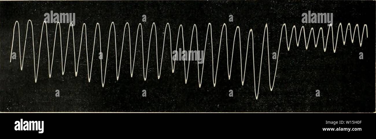 Page 2 Pulsations High Resolution Stock Photography And Images Alamy Page 2 Pulsations High Resolution Stock Photography And Images Alamy