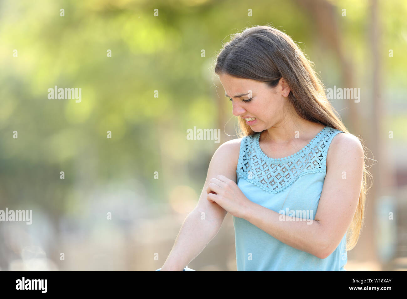 Woman scratching arm because it stings in a park with a green background Stock Photo
