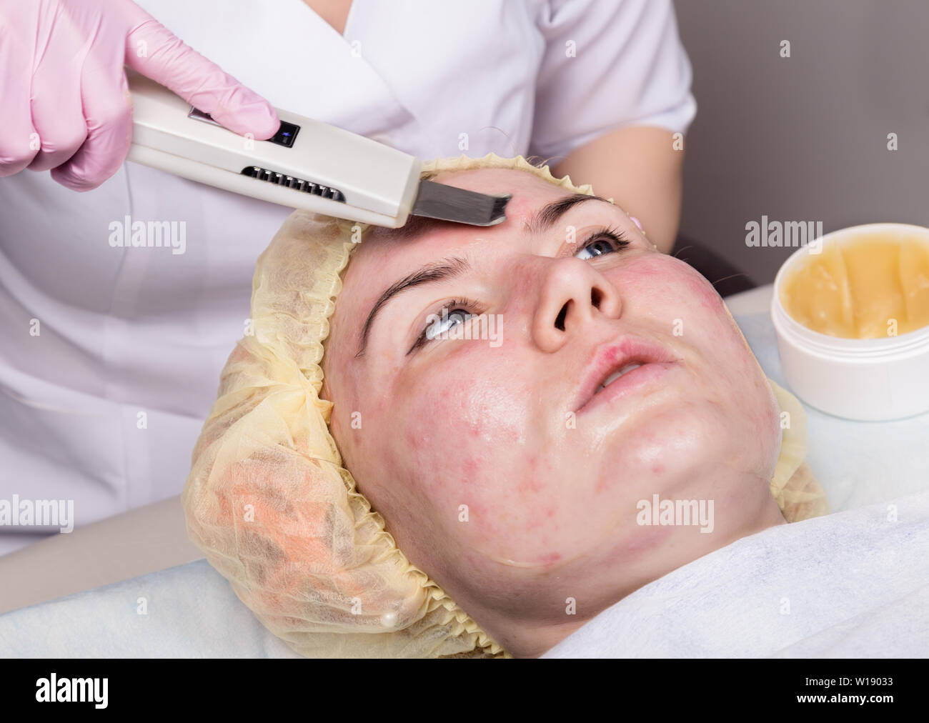 beautician at work. Ultrasonic face cleaning procedure for problem skin. Pore  cleansing, oxygen saturation for woman's face Stock Photo - Alamy