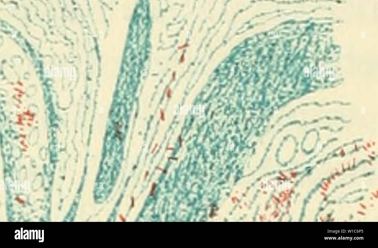 Archive image from page 543 of Die mikroorganismen Mit besonderer berücksichtigung. Die mikroorganismen. Mit besonderer berücksichtigung der ätiologie der infektionskrankheiten . diemikroorg02flgg Year: 1896  512 Systematik der Bakterien. finden, vor allem in den Knoten der Haut, der Konjunktiva und Kornea, der Schleimhaut des Mundes, Gaumens und Kehlkopfes, den Lymph- drüsen, bei den interstitiellen Prozessen der Nerven, der Hoden, der Milz, Leber und Nieren. Die Stäbchen liegen fast ausschliesslich in den Zellen des Granulationsgewebes, das die Knoten zusammensetzt, entweder regellos durchei Stock Photo