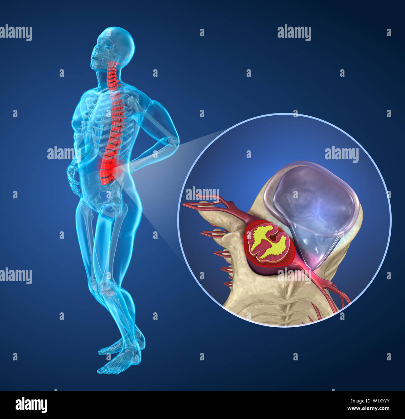 Spinal pain Attack after disc herniation, man suffering from spinal pain. 3D illustration Stock Photo