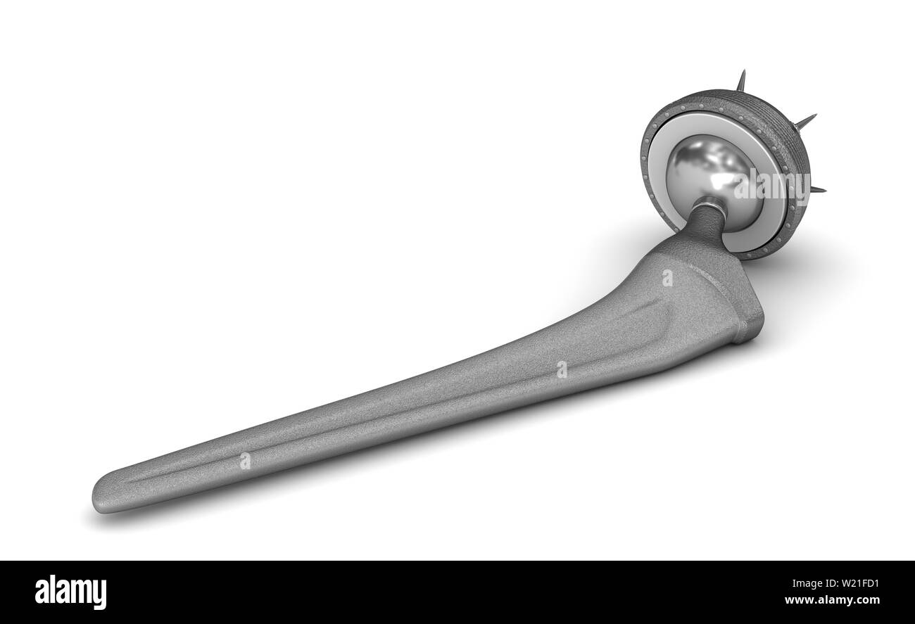 Hip replacement implant isolated on white. Medically accurate 3D