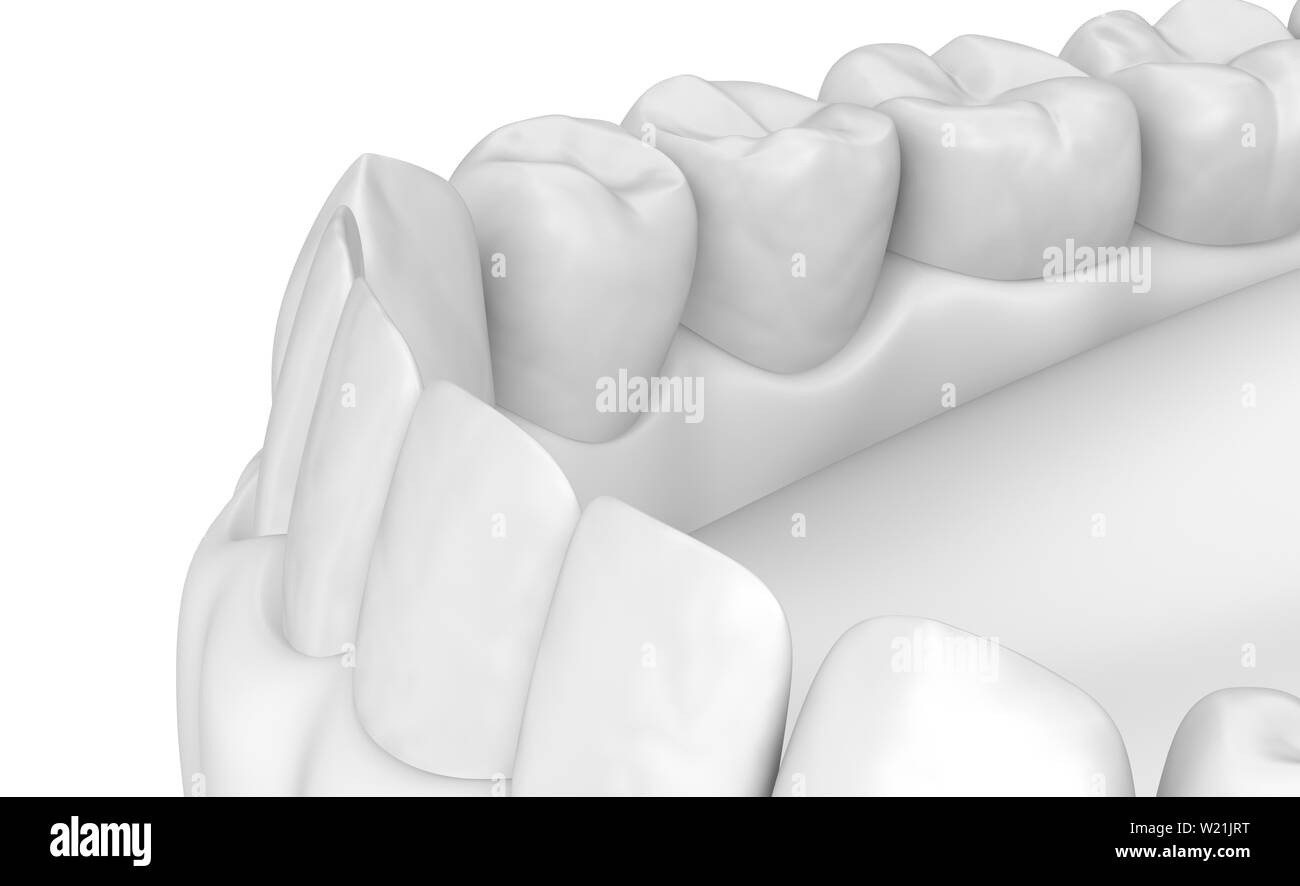 Mouth gum and teeth. White stye 3D illustration Stock Photo