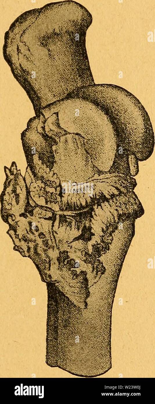 Meit High Resolution Stock Photography And Images Alamy