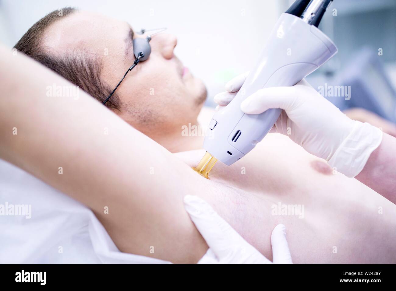 Man getting laser hair removal treatment for under arms. Stock Photo