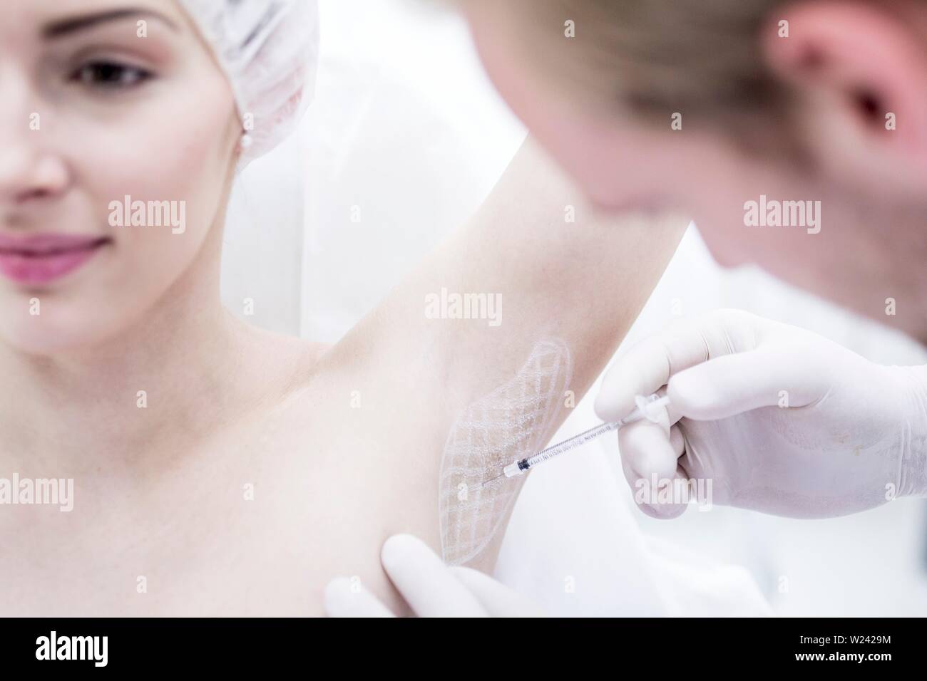 Dermatologist injecting botox in underarm to treat excessive sweating, close-up. Stock Photo
