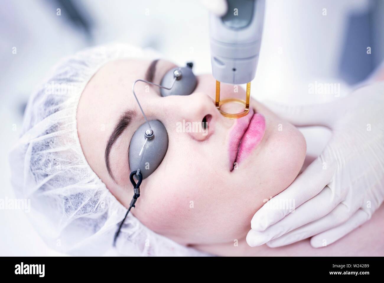 Young woman having laser hair removal treatment on face, close-up. Stock Photo