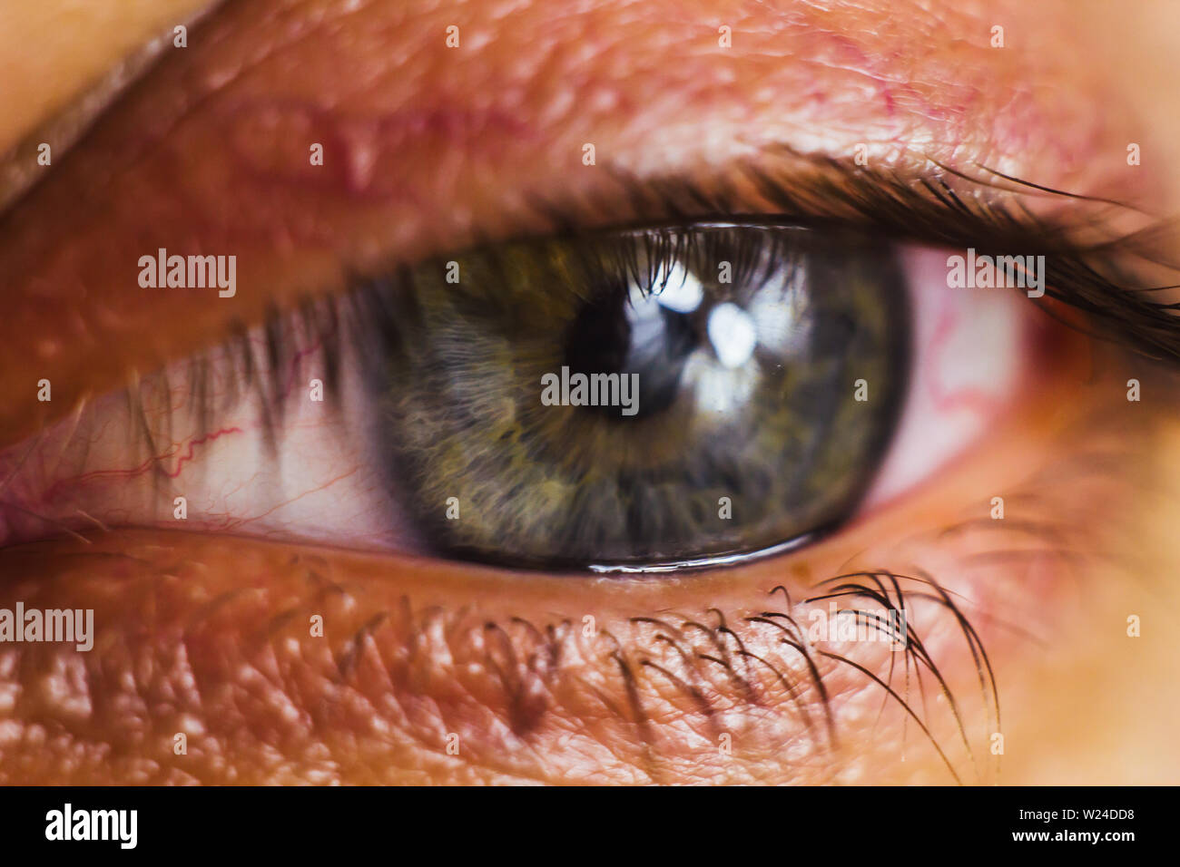 open human eye with bright red arteries close up. irritation and