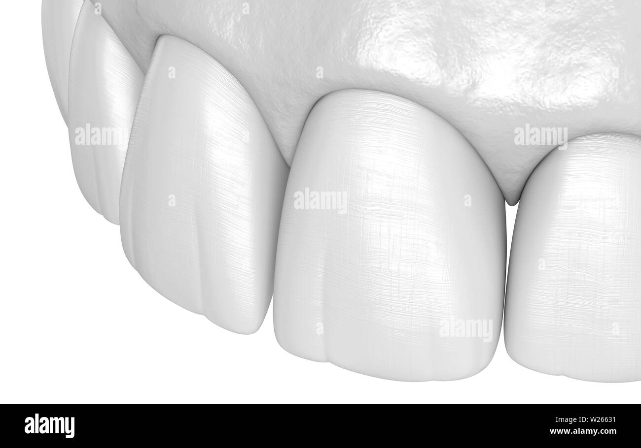 Human healthy incisors teeth Black and White Stock Photos & Images Alamy