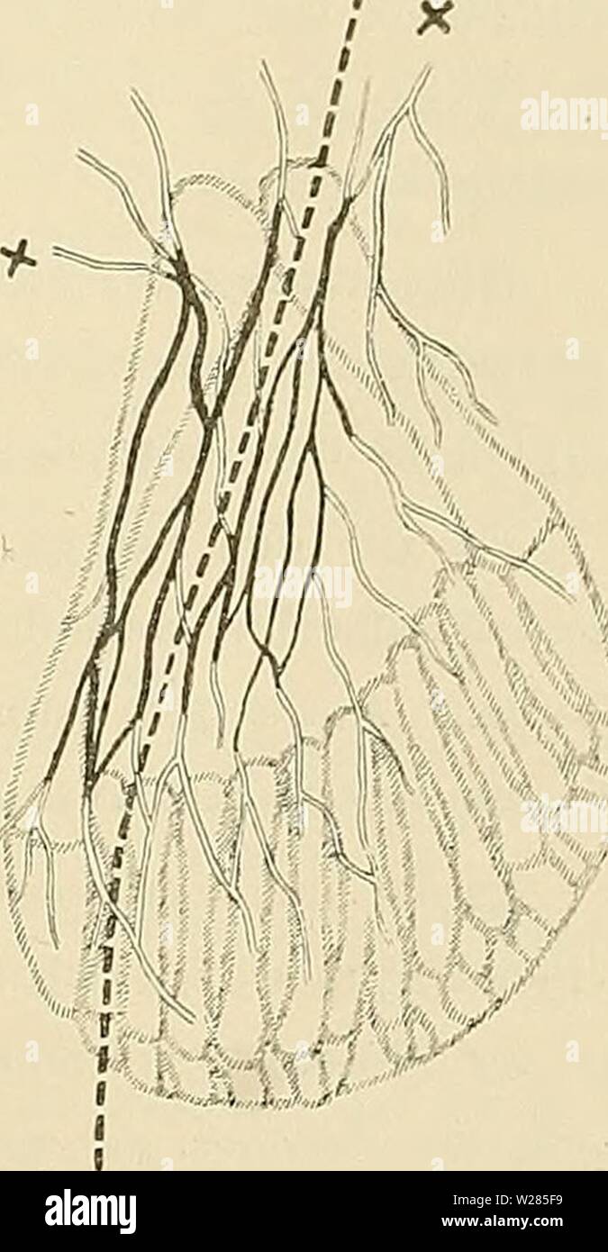 Archive image from page 364 of Denkschriften der Medicinisch-Naturwissenschaftlichen Gesellschaft zu. Denkschriften der Medicinisch-Naturwissenschaftlichen Gesellschaft zu Jena  denkschriftender413medi Year: 1879  H7 Die Muskeln und Nerven der Ceratodusflosse. 229 y) Die Stellung der Crossop tery gier-Brus tflosse zu derjenigen der übrigen Paläichthyer. Die Brustflosse des Polypterus, welche in ihrer serialen Stellung zum Rumpf derjenigen der Acipenseriden ähnlich ist, hat verschiedene wichtige Merkmale, welche allen anderen von mir untersuchten Ganoiden fehlen. Der Plexus omopterygialis dista Stock Photo