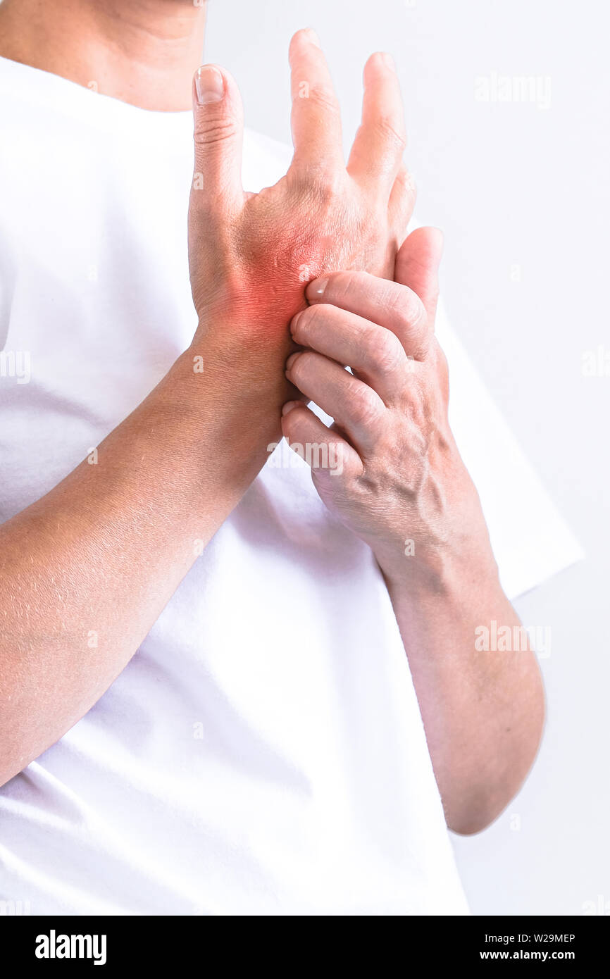 Woman Scratching an itch . Sensitive Skin, Food allergy symptoms, Irritation Stock Photo