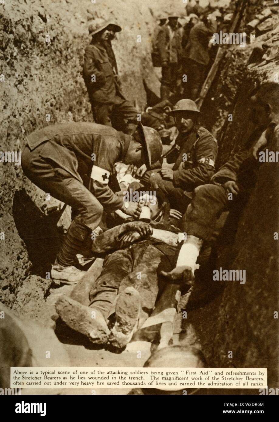 Wounded soldier being treated in the trenches, Battle of the Somme, First World War, 1916, (1935). Creator: Unknown. Stock Photo