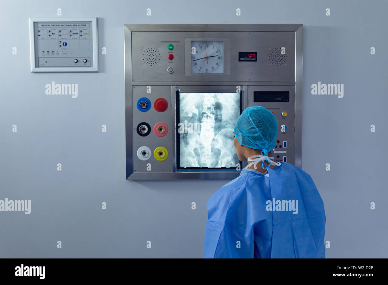 Female surgeon examining x ray on xray light box at hospital Stock