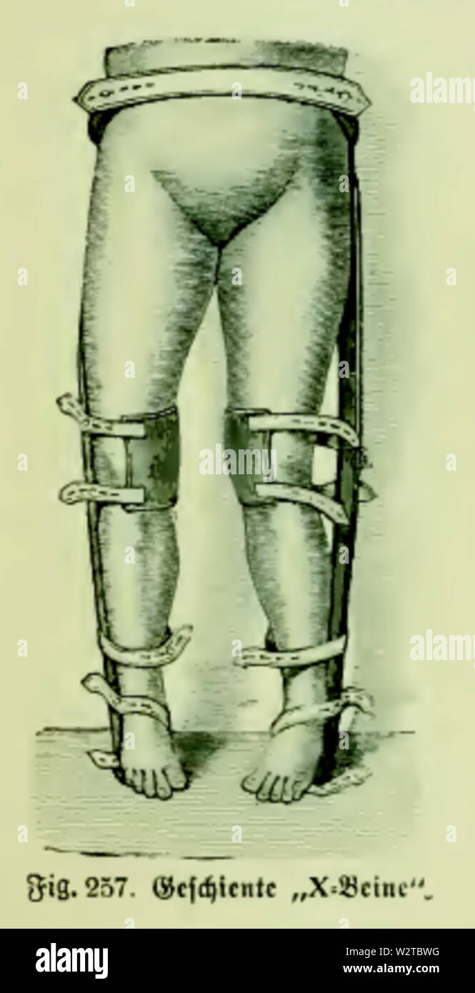Die Frau Als Hausarztin 1911 257 Geschiente X Beine Stock Photo Alamy