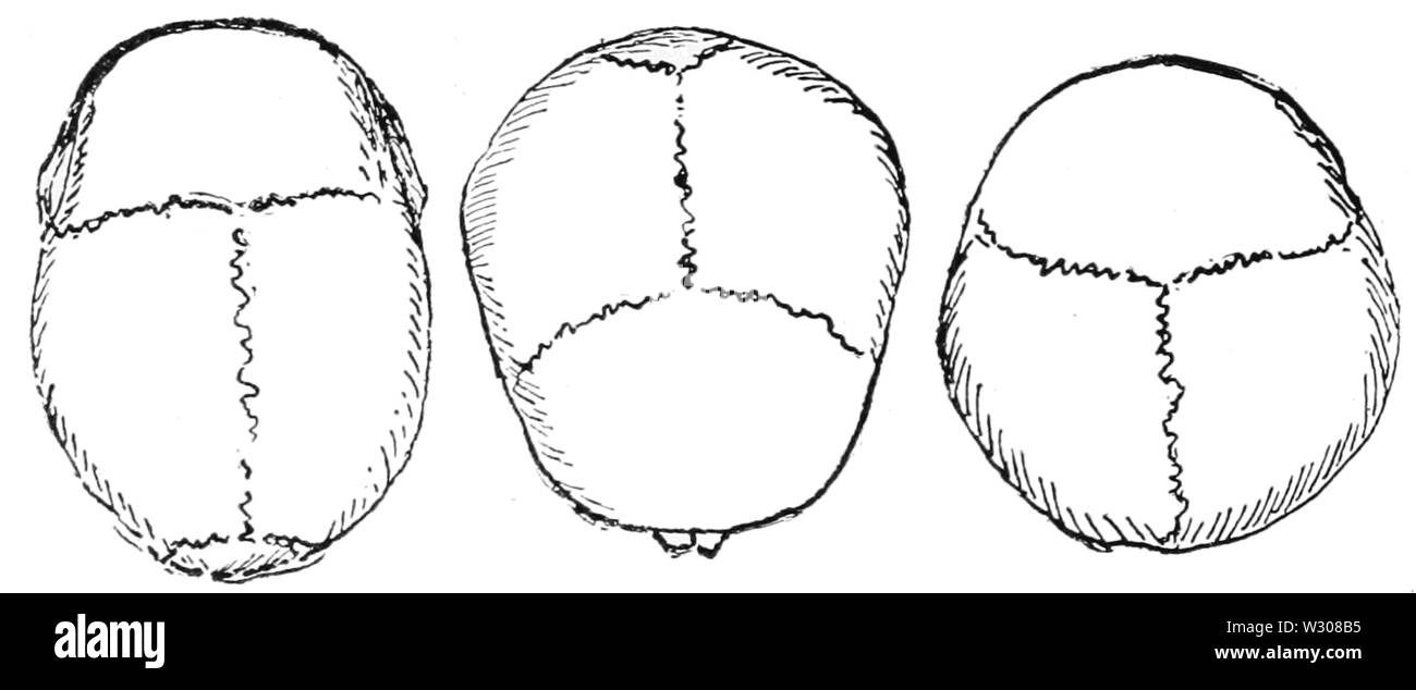 PSM V59 D402 Cranium shapes from above Stock Photo