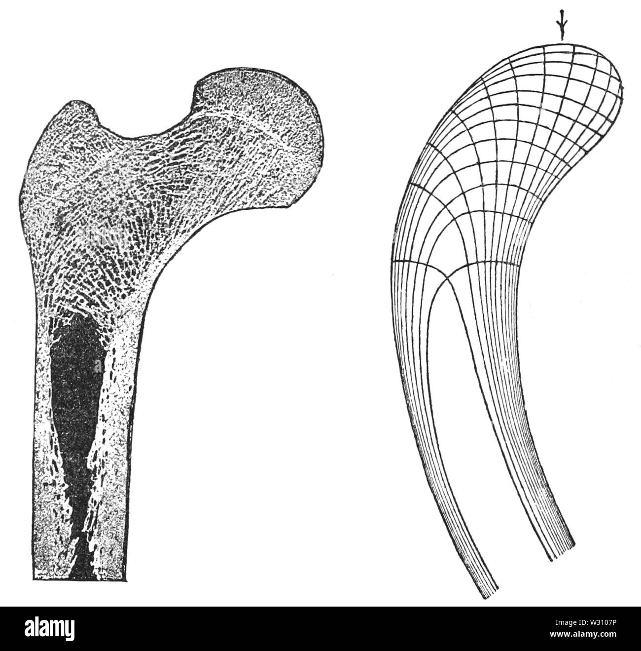 PSM V79 D460 Upper portion of a thighbone along orthogonal