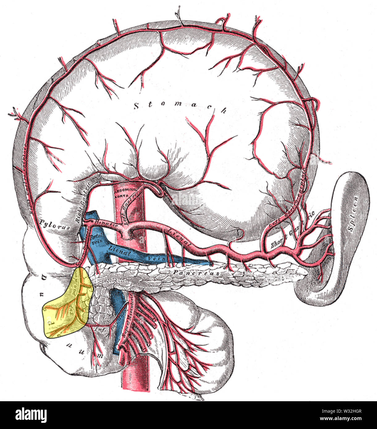 Acute Mesenteric Ischaemia – Mind The Bleep, image size:1221x1390