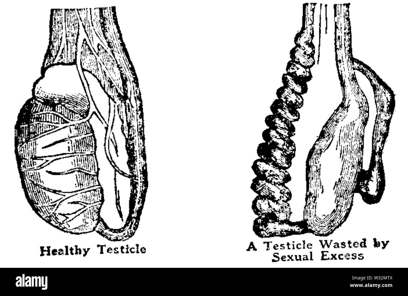 Testicle before and after Stock Photo Alamy