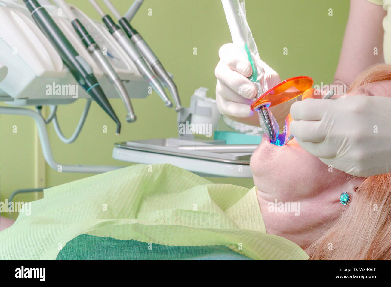 Close up view of dentist's hands use blue LED dental curing light to fix a filling. Stock Photo