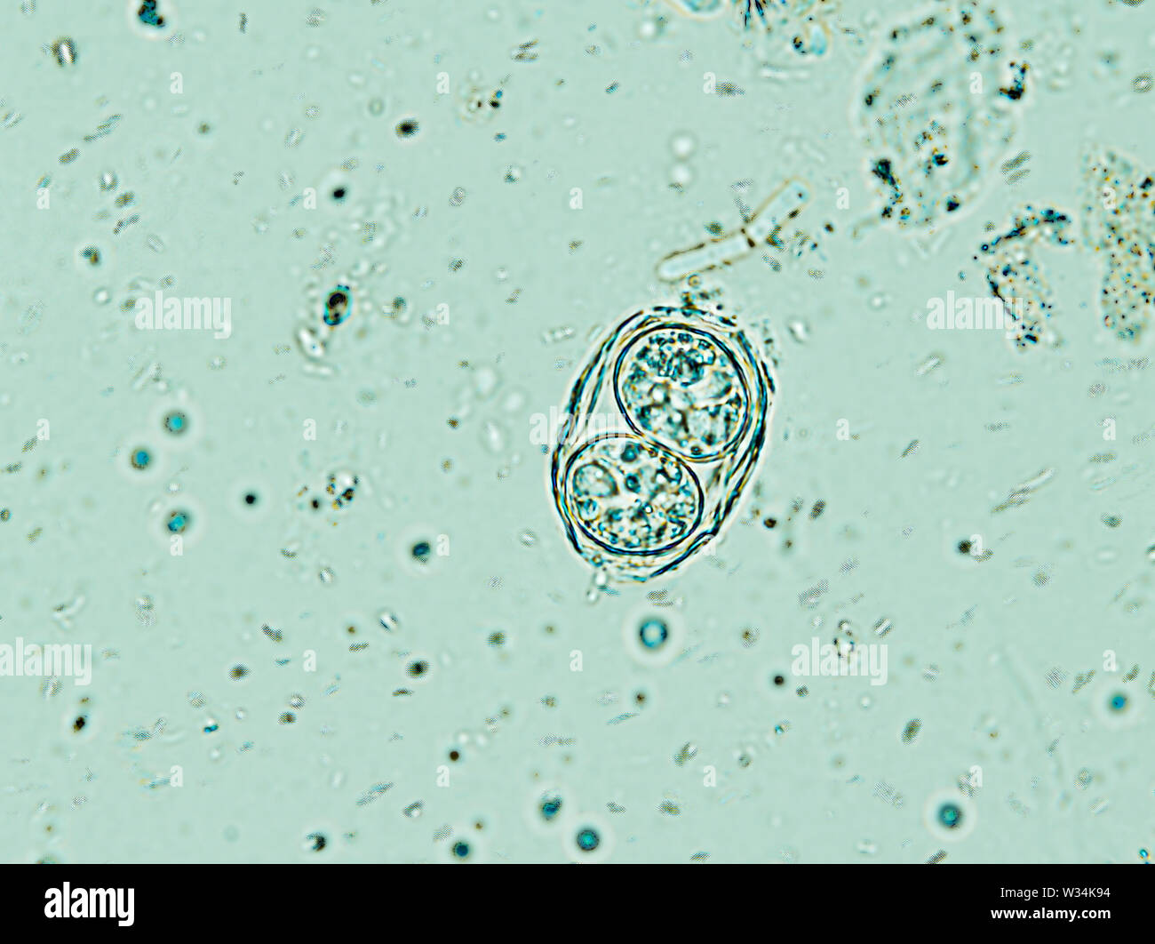Toxoplasma gondii oocyst under the microscope, isolated Stock Photo - Alamy