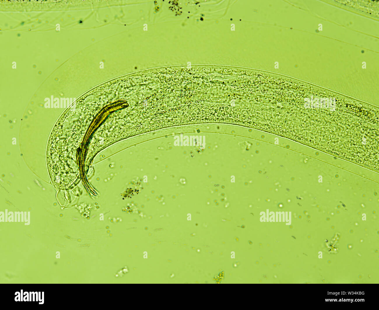the tail of Aelurostrongylus abstrusus, cat lungworm under the