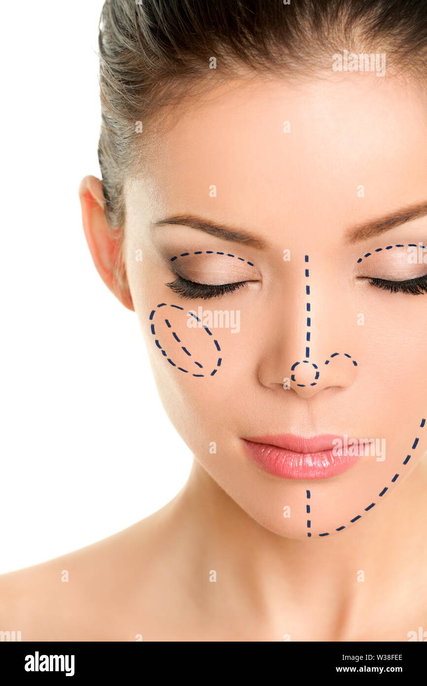 Plastic surgery lines on Asian woman face. Closeup of female adult with