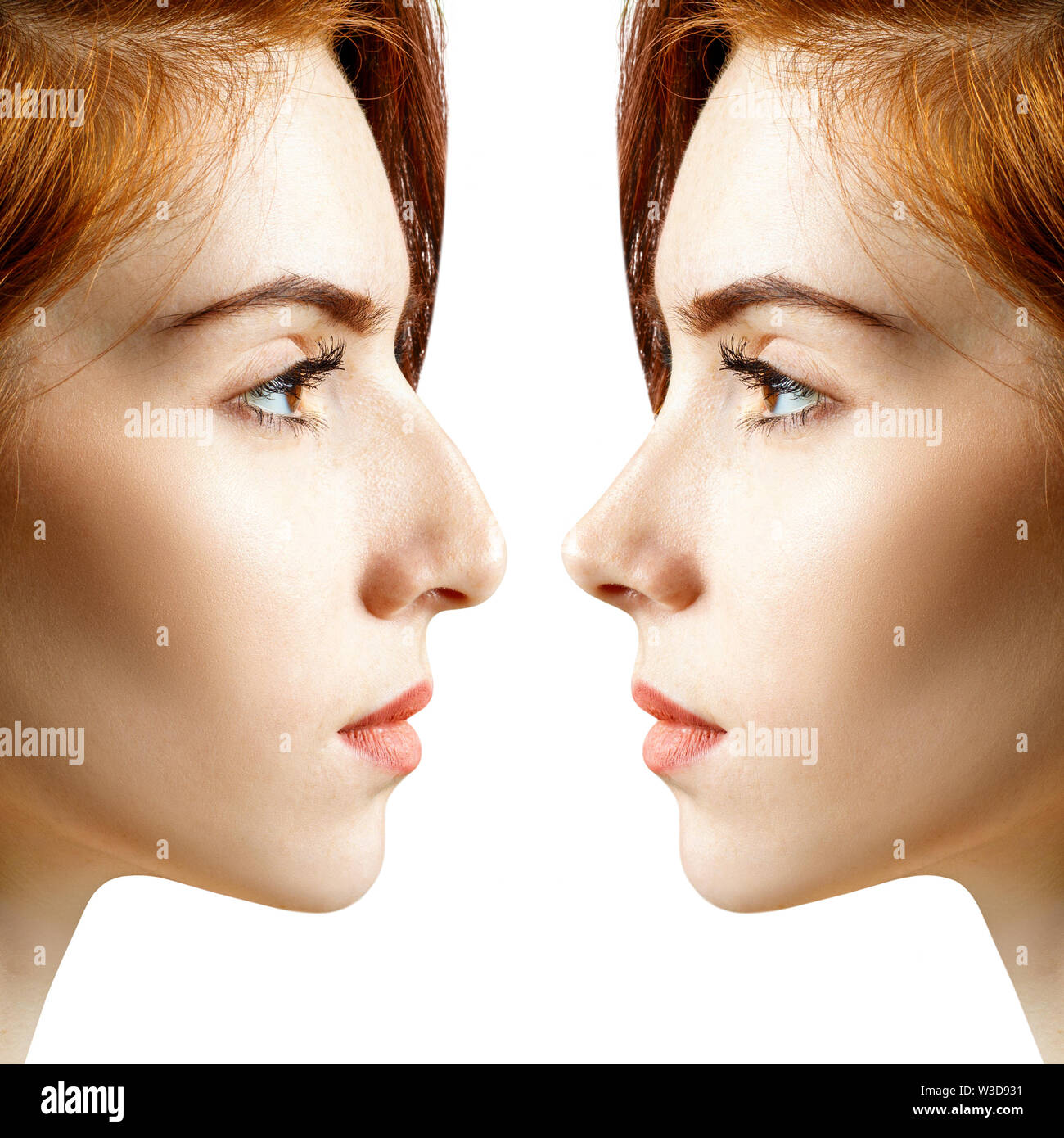 Female nose before and after cosmetic surgery. Over white background
