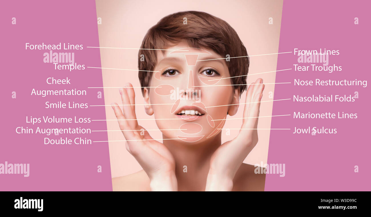 The areas for rejuvenation cosmetological injections Stock Photo - Alamy