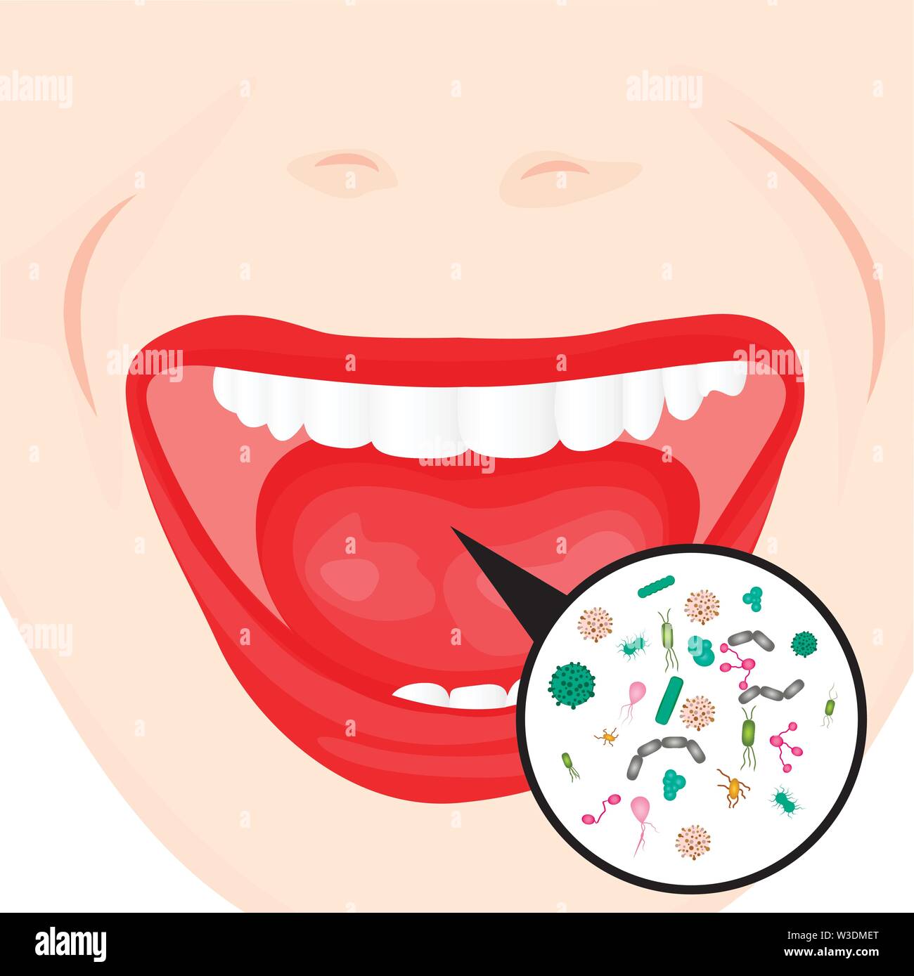 Bacterial overgrowth in a mouth.  flu, cold, other contageous diseases vector illustration on a white background Stock Vector
