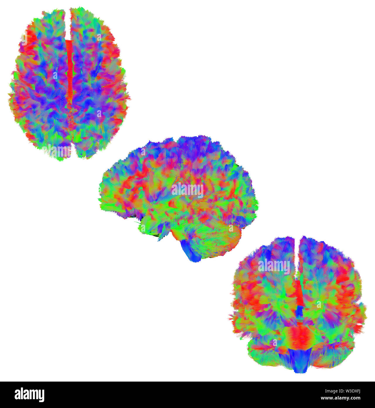 Side view of the corpus callosum of the human brain using fiber tractography. Stock Photo