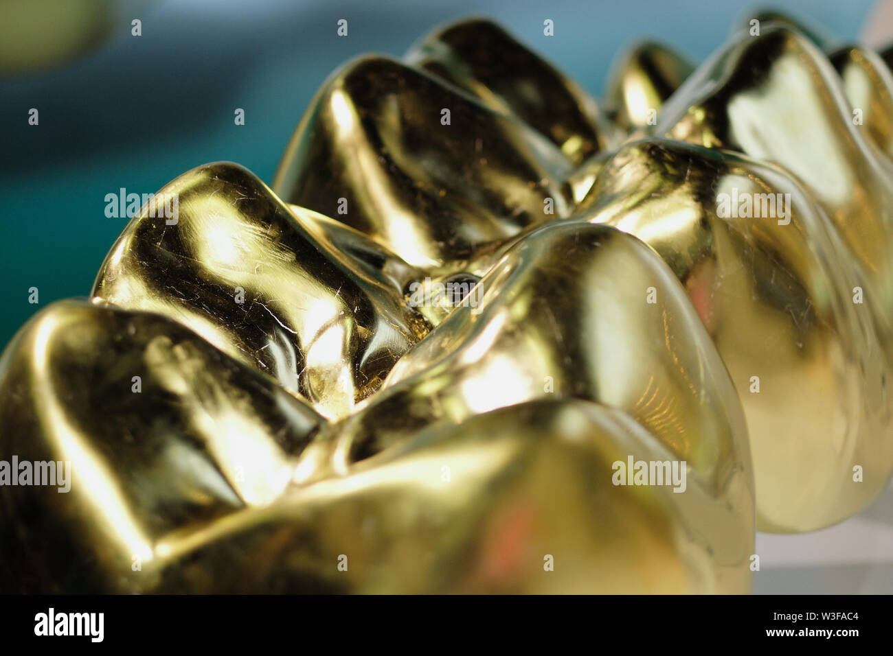 Abstract view of a series of titanium dental crowns Stock Photo Alamy
