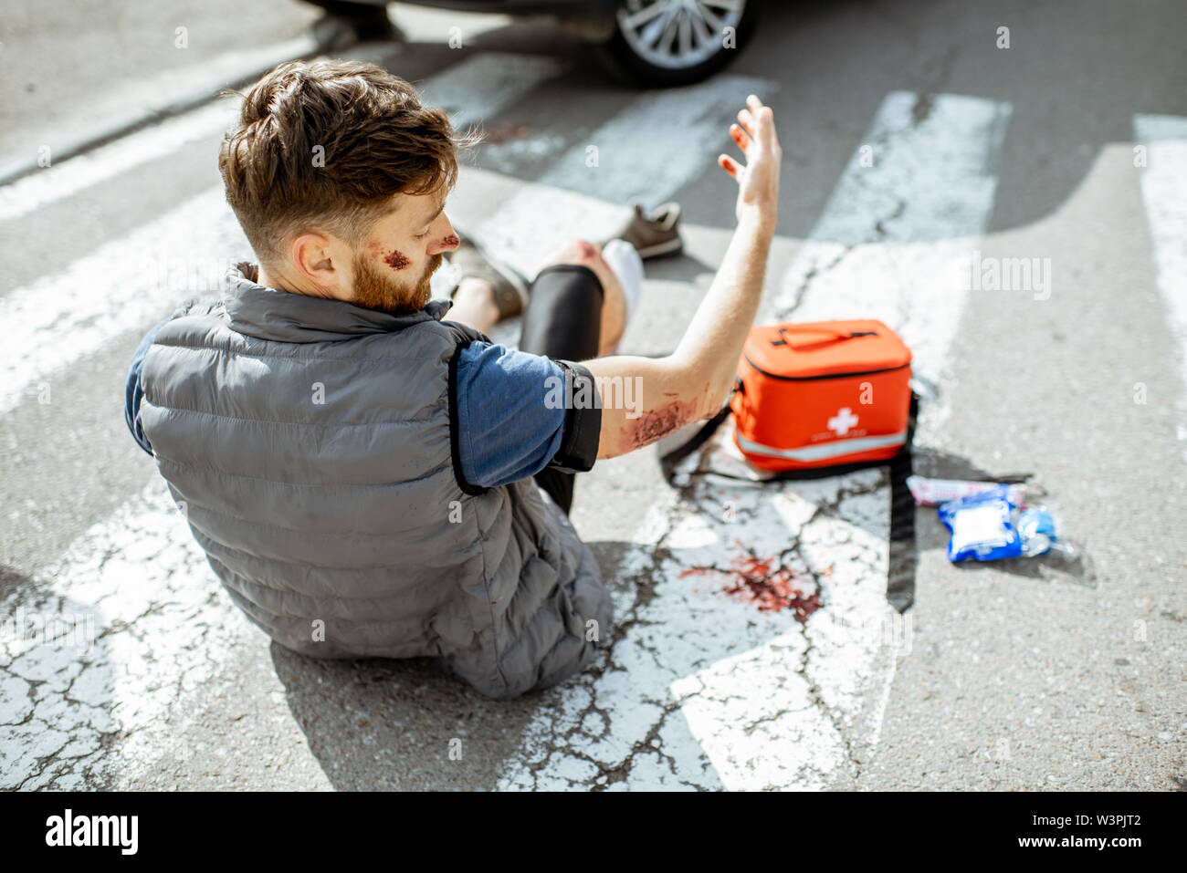 Shocked injured man looking on his wounds, waking up on the pedestrian crossing after the road accident with car Stock Photo