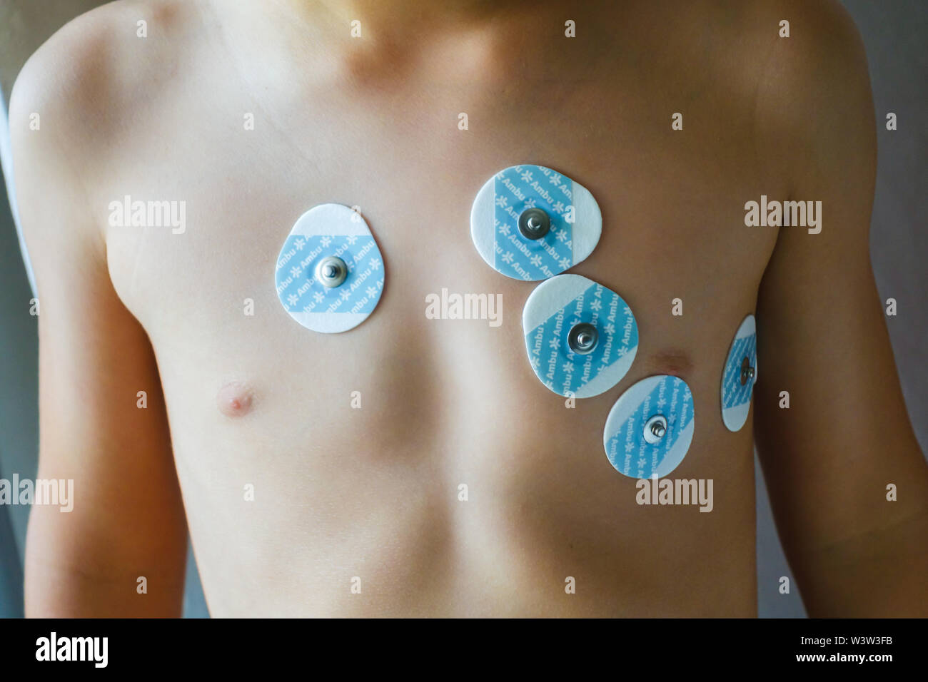 Ecg Electrode Stock Photos & Ecg Electrode Stock Images Alamy