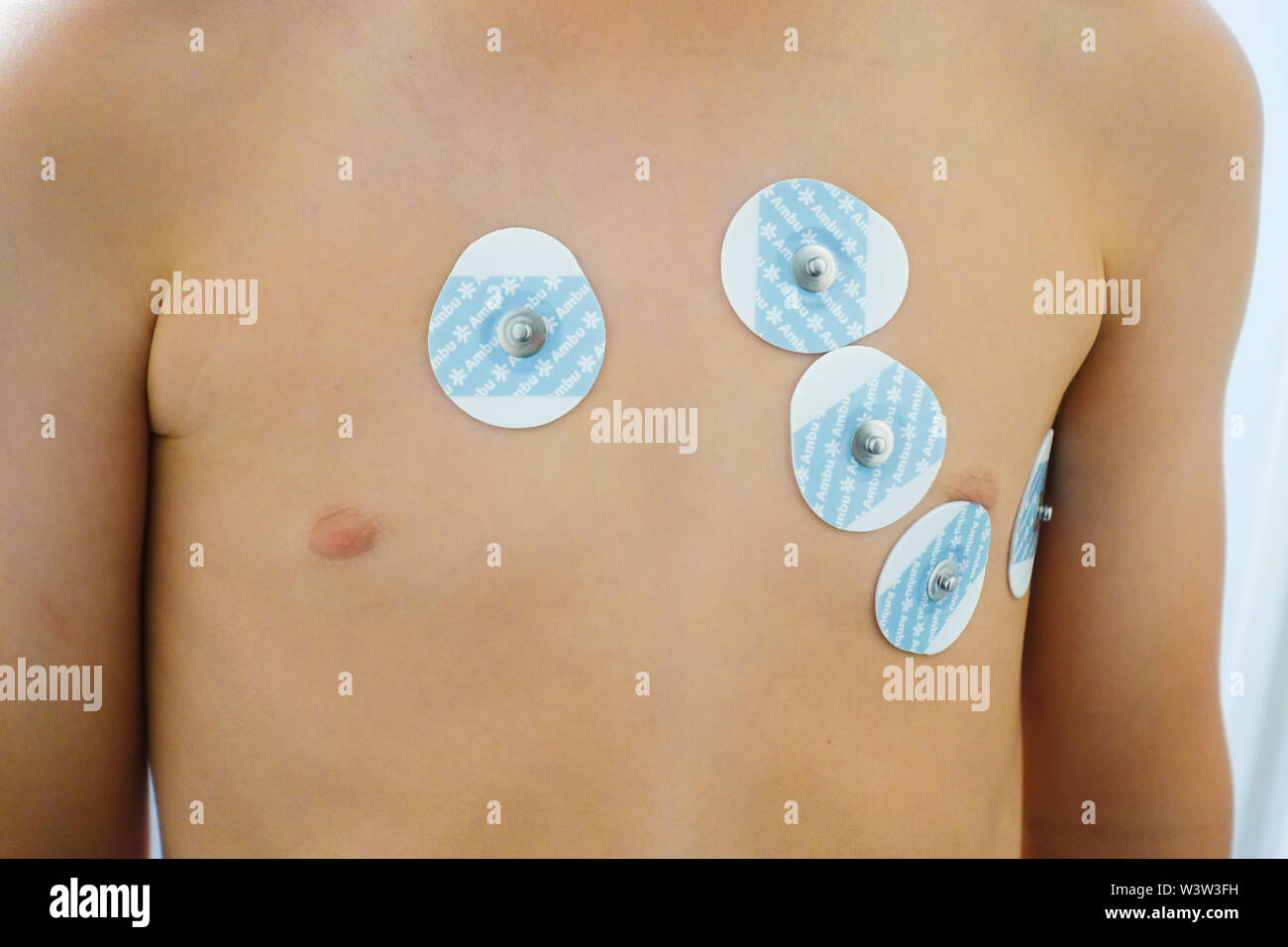 Electrodes Chest High Resolution Stock Photography and Images Alamy