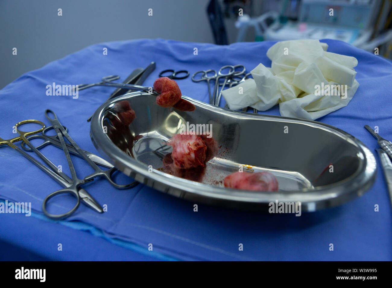Surgical instruments and kidney dish on a table in operation room of hospital Stock Photo