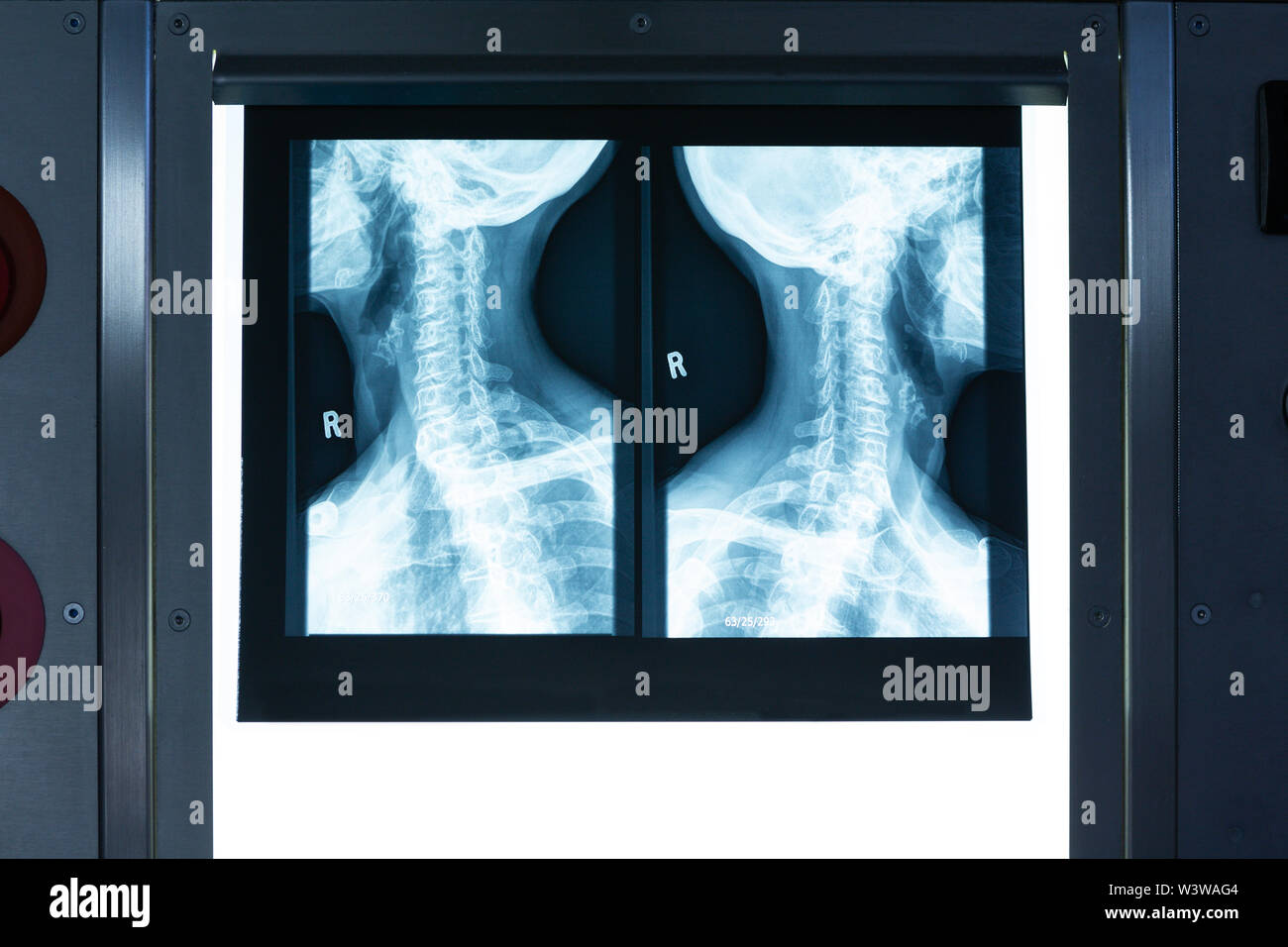 X ray light box hi-res stock photography and images - Alamy