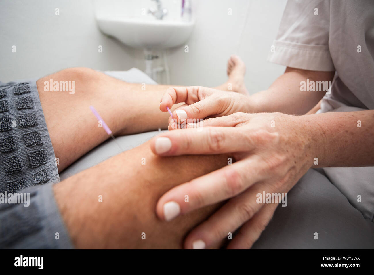 Hand acupuncture therapy points hi-res stock photography and images - Alamy