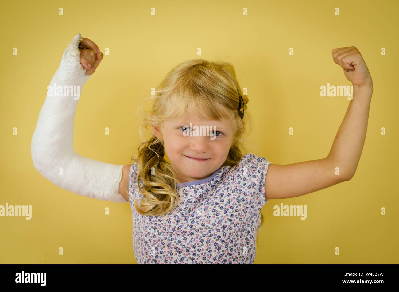 hurt blond girl with broken hand doing sport gesture of strength and triumph Stock Photo