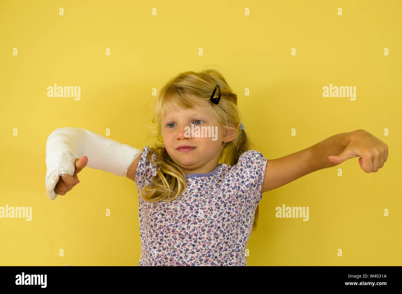 hurt blond girl with broken hand doing sport gesture of strength and triumph Stock Photo