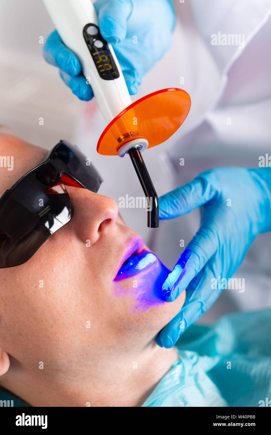 Dental Uv High Resolution Stock Photography and Images Alamy