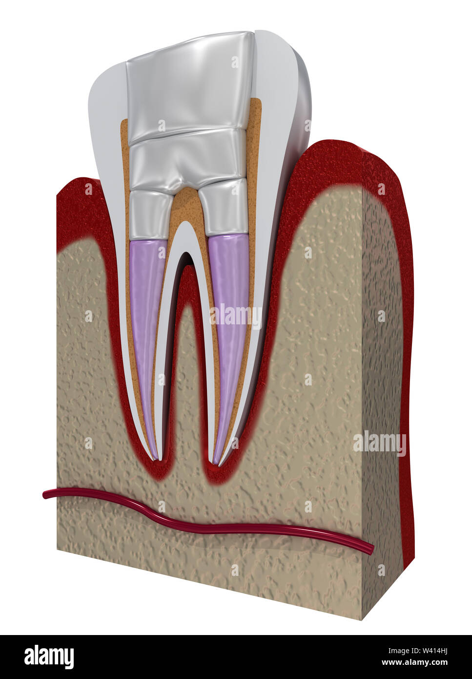 Dental fillings procedure diagramm . 3D illustration Stock Photo Alamy