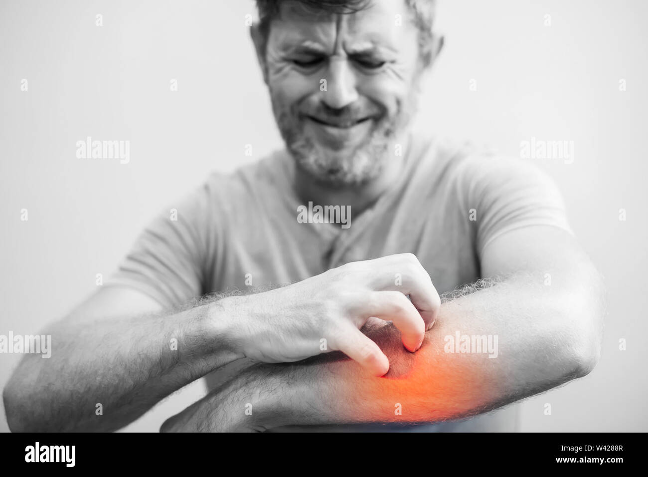 People scratch the itch with hand, Elbow, itching, Healthcare And Medicine, Men with skin problem concept Stock Photo