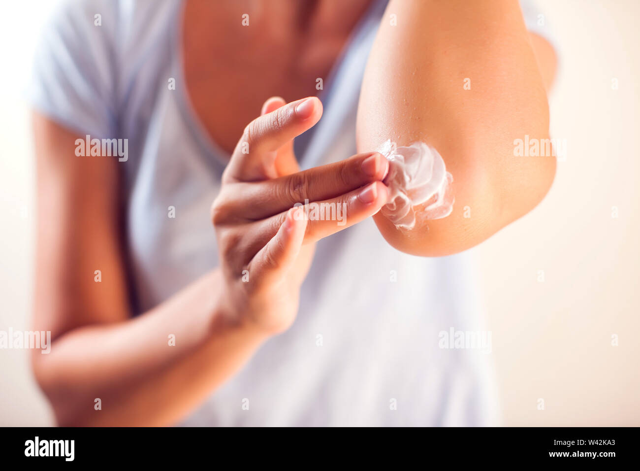 Woman applies cream on her elbow.People, healthcare and medicine concept Stock Photo