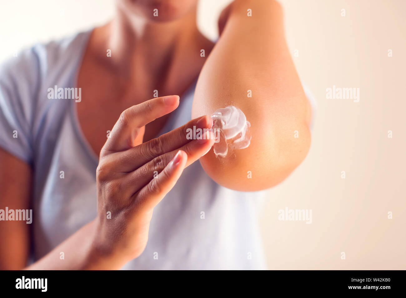 Woman applies cream on her elbow.People, healthcare and medicine concept Stock Photo