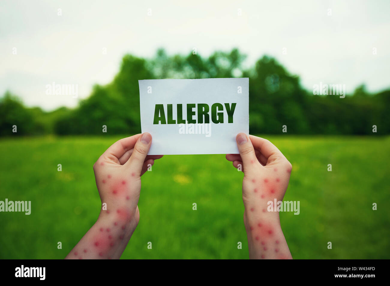 Allergic woman hands holding a paper sheet with allergy text over a green field natural