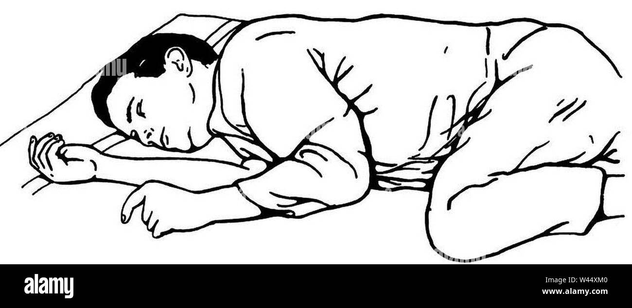 Coma Position Stock Photo Alamy