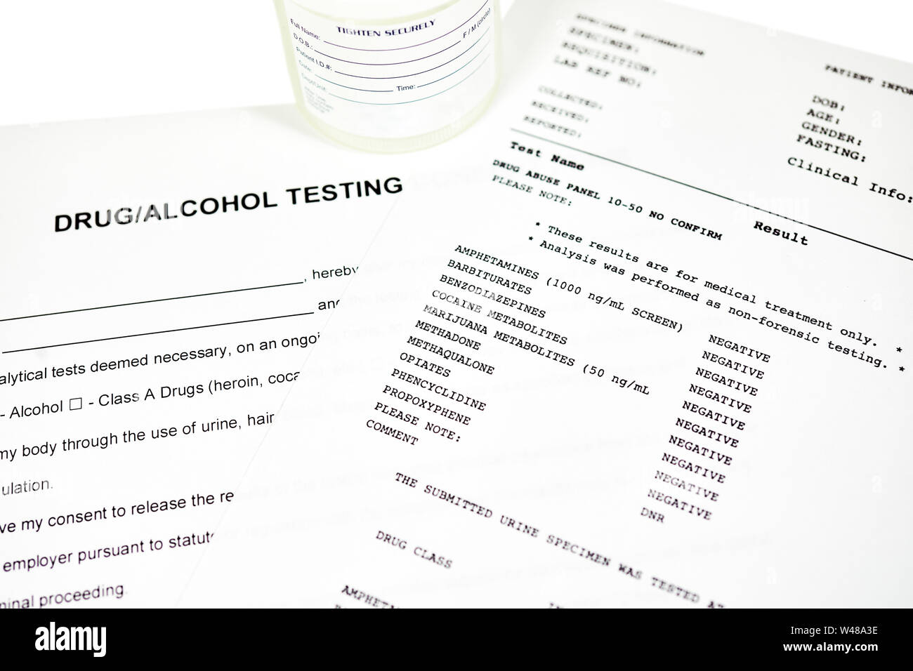 Urine Test Report